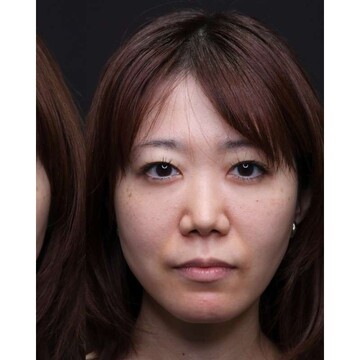 聖心美容クリニックの症例写真[アフター]