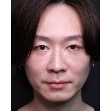 聖心美容クリニックの症例写真[アフター]