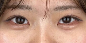 AI Beauty Clinicの症例写真[アフター]
