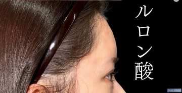 PRISM Beauty Clinicの症例写真[アフター]