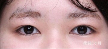 聖心美容クリニックの症例写真[アフター]