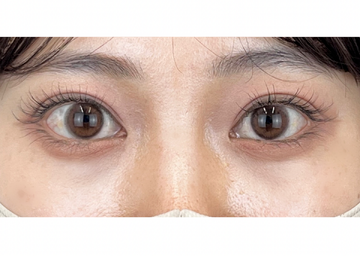 AI Beauty Clinicの症例写真[アフター]