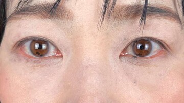 AI Beauty Clinicの症例写真[アフター]