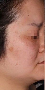 Select Clinic セレクトクリニック 表参道院の症例写真 美容医療の口コミ広場 Select Clinic セレクトクリニック 表参道院の症例写真 美容医療の口コミ広場
