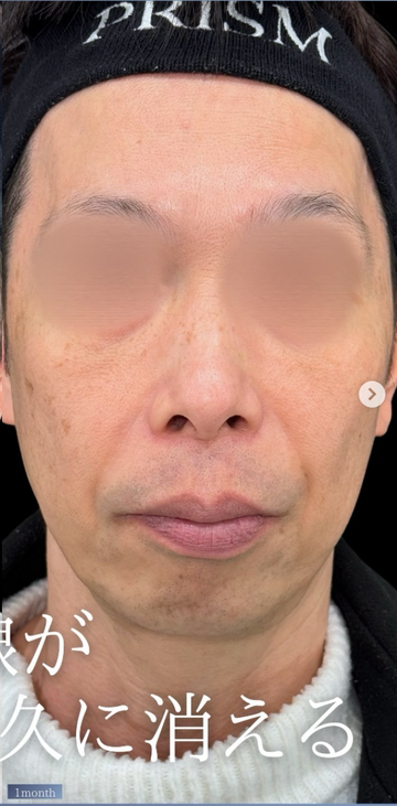PRISM Beauty Clinicの症例写真[アフター]