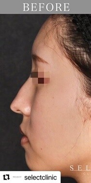 Select Clinic セレクトクリニック 表参道院の鼻の整形 美容医療の口コミ広場