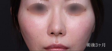 聖心美容クリニックの症例写真[アフター]