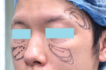 医療法人秀晄会 心斎橋コムロ美容外科クリニックの症例写真[アフター]