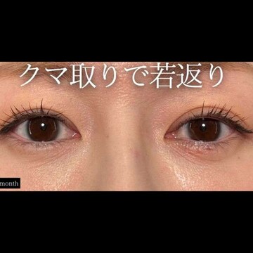 PRISM Beauty Clinicの症例写真[アフター]