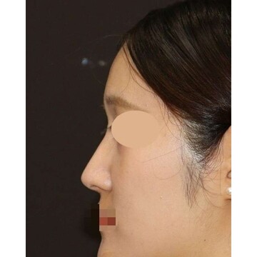 聖心美容クリニックの症例写真[アフター]