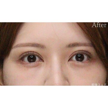 聖心美容クリニックの症例写真[アフター]