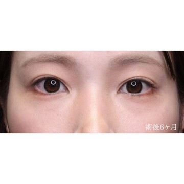 聖心美容クリニックの症例写真[アフター]