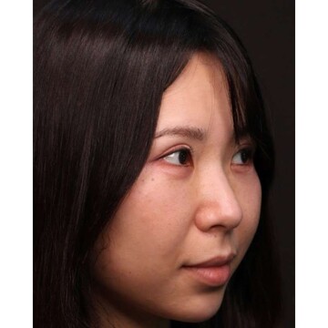 聖心美容クリニックの症例写真[アフター]