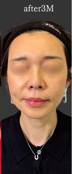 Plume Clinicの症例写真[アフター]
