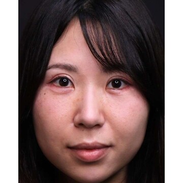 聖心美容クリニックの症例写真[アフター]