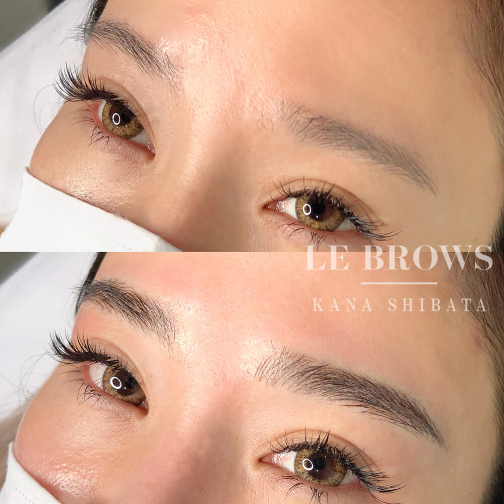 ふさふさの眉毛へ 眉のアートメイクの症例写真 画像 エレナクリニック 新宿本院 Cs 美容医療の口コミ広場