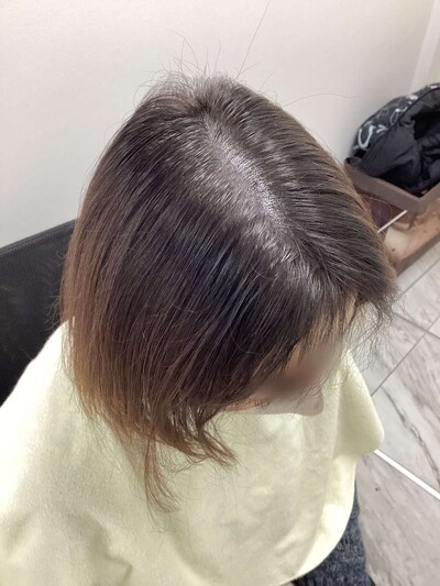 ヘアアートメイク｜50代｜2回の症例写真[アフター]