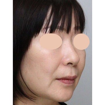 聖心美容クリニックの症例写真[アフター]