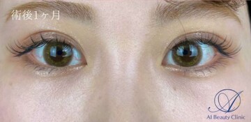 AI Beauty Clinicの症例写真[アフター]