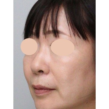 聖心美容クリニックの症例写真[アフター]