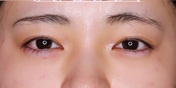 Select Clinic セレクトクリニック 表参道院の目元整形 クマ治療 美容医療の口コミ広場