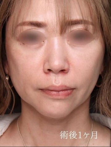 聖心美容クリニックの症例写真[アフター]