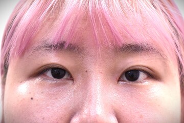 医療法人秀晄会 心斎橋コムロ美容外科クリニックの目・二重整形の症例写真