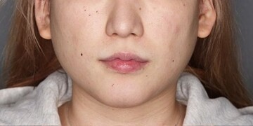 Select Clinic セレクトクリニック 表参道院の症例写真 美容医療の口コミ広場