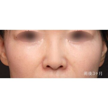 聖心美容クリニックの症例写真[アフター]
