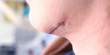 医療法人秀晄会 心斎橋コムロ美容外科クリニックの症例写真[アフター]