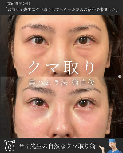 裏ハムラの症例写真