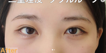 さかえ皮フ科クリニック（旧：ニドークリニック名古屋）の症例写真[アフター]