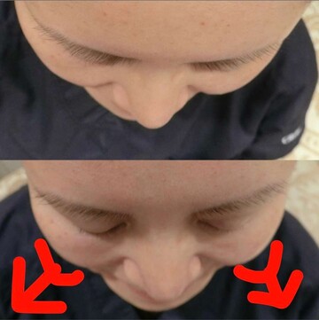 やさしい美容皮膚科・皮フ科 秋葉原院/シミレーザー東京のその他の美容皮膚科治療の症例写真