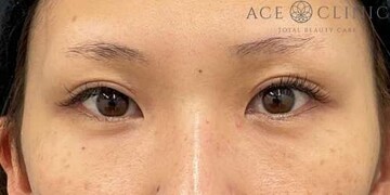 エースクリニックグループの症例写真[アフター]