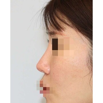 聖心美容クリニックの症例写真[アフター]
