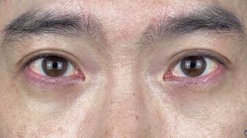 AI Beauty Clinicの症例写真[アフター]