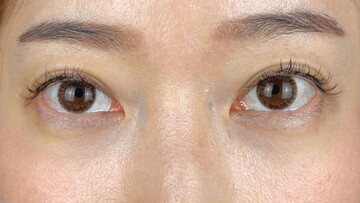 AI Beauty Clinicの症例写真[アフター]