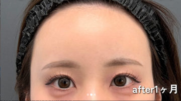 Plume Clinicの症例写真[アフター]