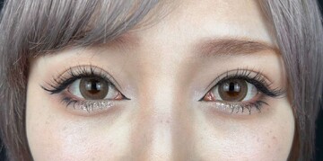 AI Beauty Clinicの症例写真[アフター]