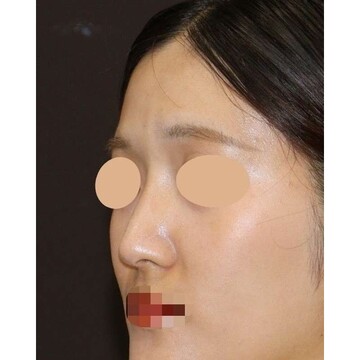 聖心美容クリニックの症例写真[アフター]