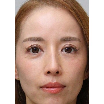 聖心美容クリニックの症例写真[アフター]