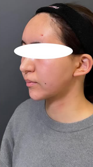 Plume Clinicの症例写真[アフター]