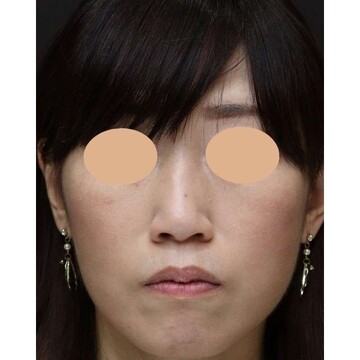 聖心美容クリニックの症例写真[アフター]