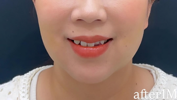 Plume Clinicの症例写真[アフター]