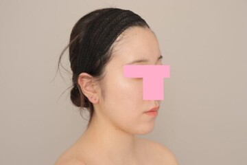 Mods Clinic (モッズクリニック)の症例写真[アフター]