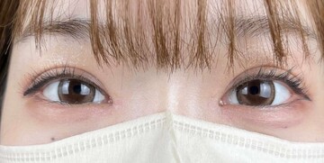 AI Beauty Clinicの症例写真[アフター]