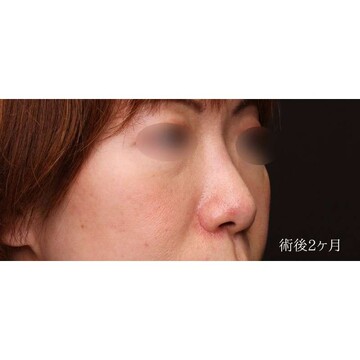 聖心美容クリニックの症例写真[アフター]
