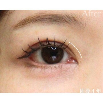 聖心美容クリニックの症例写真[アフター]