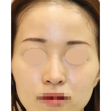 聖心美容クリニックの症例写真[アフター]