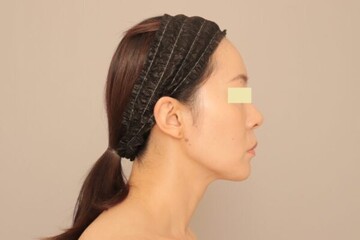Mods Clinic (モッズクリニック)の症例写真[アフター]